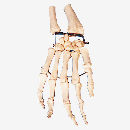 Mô hình bộ xương tay người tỷ lệ 11 chất liệu nhựa PVC VIETVALUE