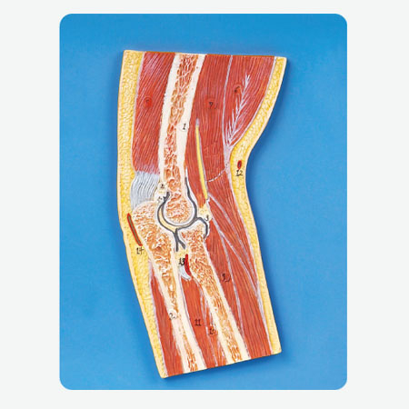 Mô hình phần khớp khuỷu tay