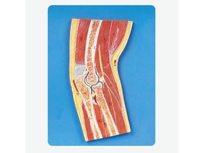 Mô hình phần khớp khuỷu tay