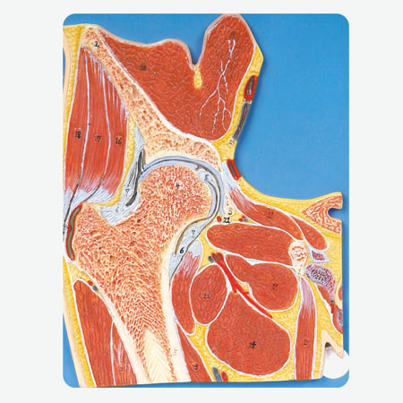 Mô hình khớp hông