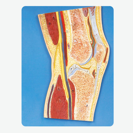 Mô hình khớp đầu gối