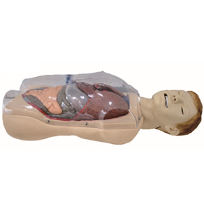 Mô hình cấp cứu chảy máu giãn tĩnh mạch thực quản