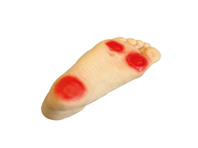 Mô hình điều dưỡng chân cho người bệnh tiểu đường