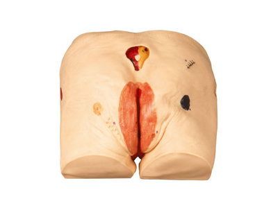 Mô hình chăm sóc vết loét