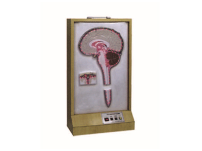 Mô hình dịch não tủy