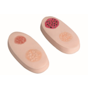 Mô hình tổn thương do mụn nhọt