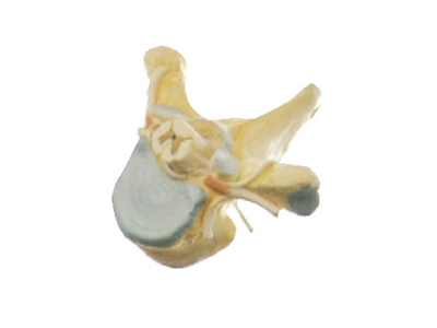 Mô hình đốt sống ngực và tủy sống