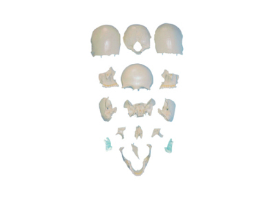 Mô hình xương sọ tháo rời