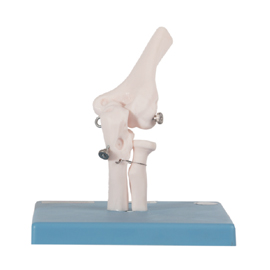 Mô hình khớp khuỷu tay