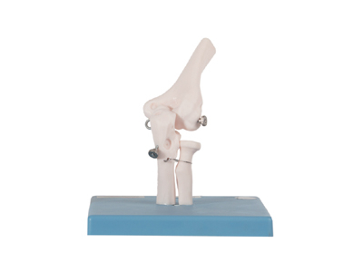 Mô hình khớp khuỷu tay