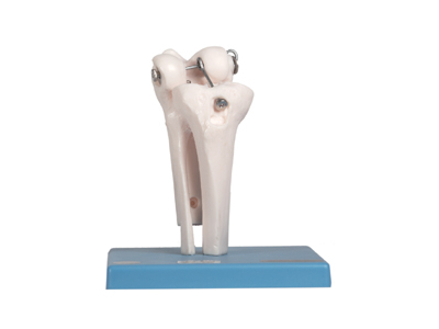 Mô hình khớp gối
