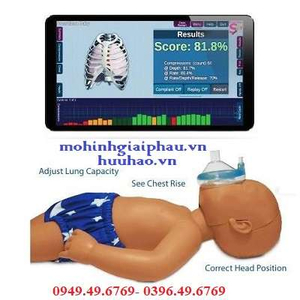 Mô hình hồi sức cấp cứu trẻ sơ sinh có kết nối máy tính Baby CPR PRO B201