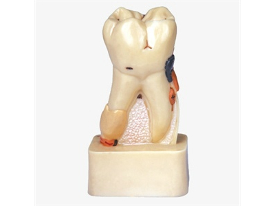 Mô hình mổ xẻ bệnh răng miệng