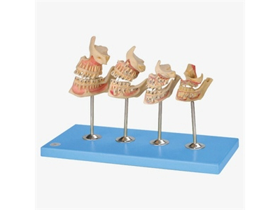 Mô hình mô phỏng quá trình phát triển của bộ răng