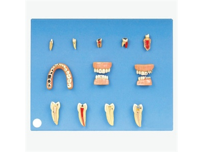 Mô hình bệnh răng miệng