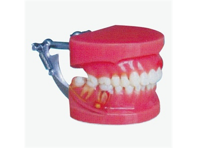 Mô hình mô phỏng bệnh nha chu