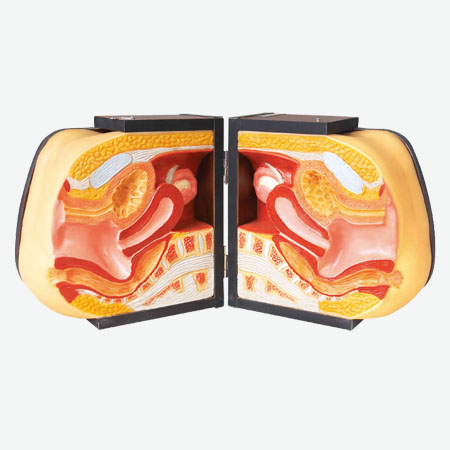 Mô hình mô phỏng đào tạo IUD nâng cao