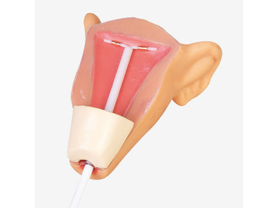 Mô hình đặt vòng tránh thai