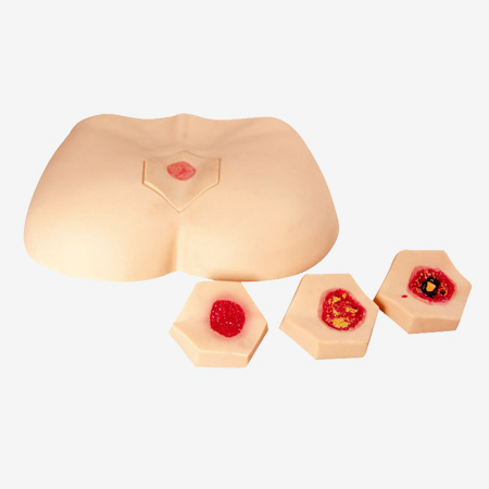 Mô hình mô phỏng chăm sóc vết loét