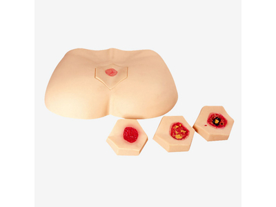 Mô hình mô phỏng chăm sóc vết loét