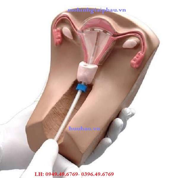 Mô hình thăm khám đặt dụng cụ tử cung