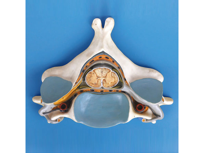 Mô hình đốt sống cổ thứ năm với tủy sống và dây thần kinh