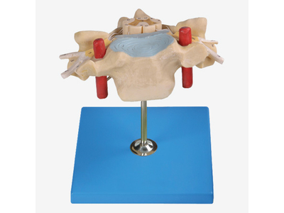 Mô hình đốt sống cổ và tủy sống