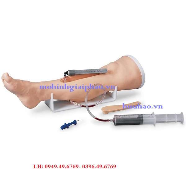 Mô hình điều dưỡng truyền dịch trong xương chân