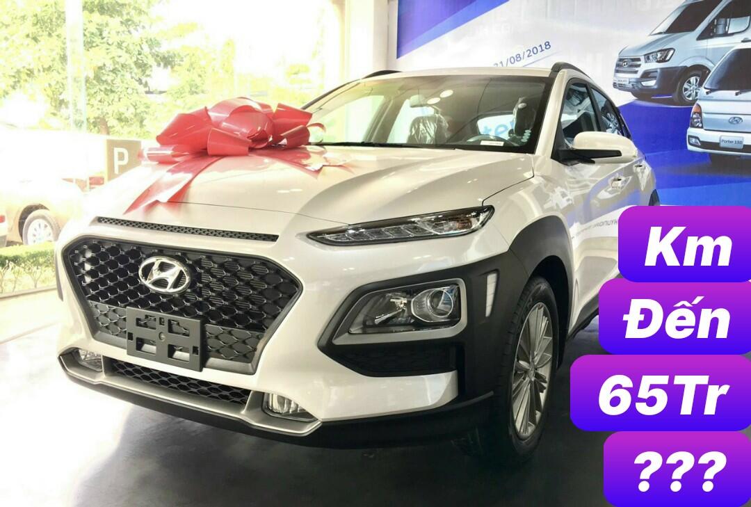 Bảng Giá Xe Hyundai Kona Tháng 7 2021 0903 119 331 Auto