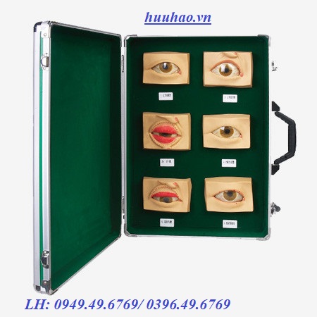 Mô hình bệnh lý về mắt hay gặp