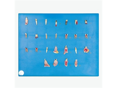 Mô hình bệnh răng miệng