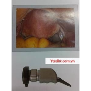 BỘ NỘI SOI TAI MŨI HỌNG GIÁ RẺ