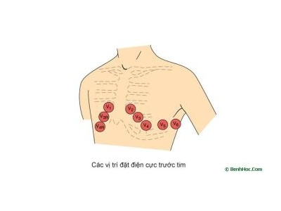 Các bước đọc điện tâm đồ
