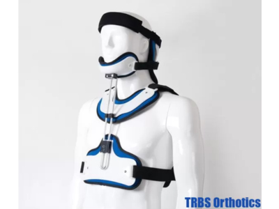 Nẹp chỉnh hình gãy xương đầu, cổ, lồng ngực