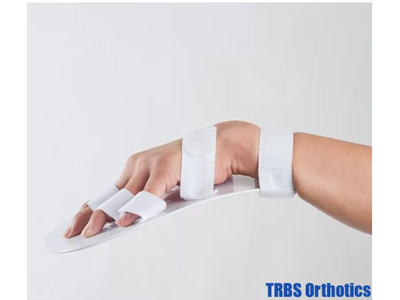 Nẹp chỉnh hình ngón tay cổ tay