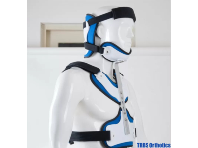 Nẹp chỉnh hình gãy xương đầu, cổ, ngực