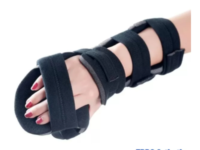 Nẹp chỉnh hình gãy bàn tay