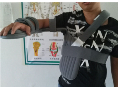 Nẹp hỗ trợ chấn thương vai