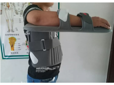 Nẹp hỗ trợ chấn thương vai