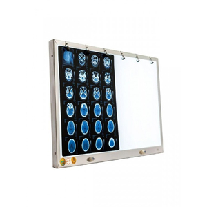 Đèn đọc 2 phim X-Quang, CT, MRI TNE (LED)