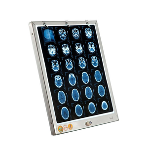 Đèn đọc 1 film X-Quang, CT, MRI