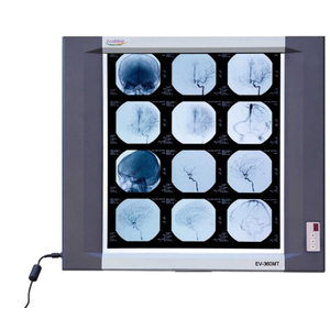 Đèn Đọc Phim X-Quang Ecomed EV-360MT