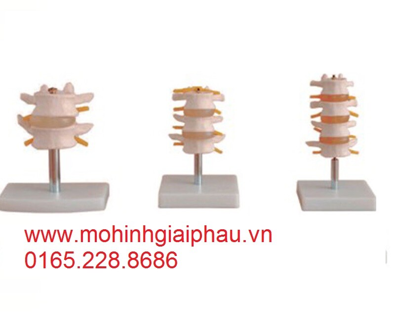 Mô hình đốt sống thắt lưng