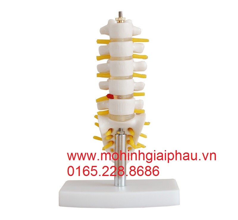 Mô hình đốt sống thắt lưng với xương cùng, xương cụt và thoát vị đĩa đệm  loại mini