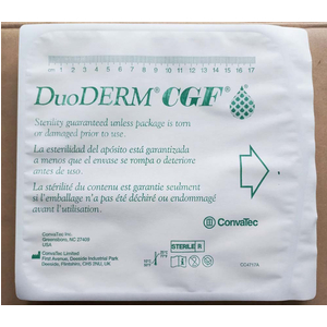 Băng dán vết thương DuoDERM CGF