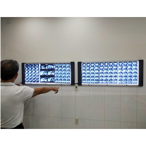 Đèn đọc 3 phim X-Quang EcoMed EV-1100MT