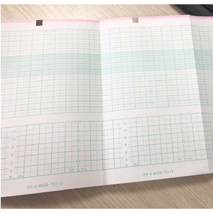 Giấy monitor sản khoa Edan F9 (sọc xanh) (152x90x150)