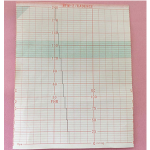 Giấy ghi kết quả sản khoa Edan, Cadence II, MFM-809 (112x90x150)