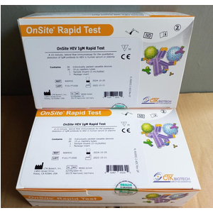 Khay thử xét nghiệm định tính kháng thể IgM kháng HEV (Onsite HEV IgM Rapid test) CTK