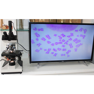 Kính hiển vi 3 mắt Novel DMK-1490